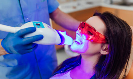 What is Laser Teeth Whitening? And Why Should You Care?
