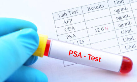 Tests for Prostate Cancer: Why You Must Take It Seriously?